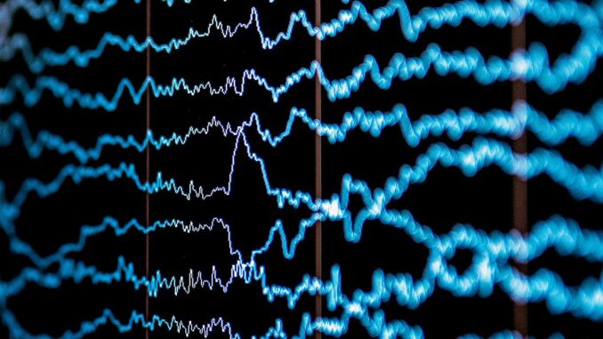 Tech Shares Pain Perception Measured by Brain Waves
